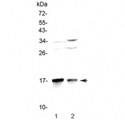 Western blot testing of 1) rat brain and 2) mouse brain lysate with LC3A antibody at 0.5ug/ml. Predicted molecular weight ~14 kDa.
