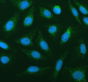 Western blot testing of human HeLa cell lysate with PLA2G6 antibody at 0.5ug/ml. Expected molecular weight: 85-90 kDa.