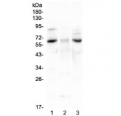Western blot testing of 1) rat brain, 2) rat stomach and 3) mouse brain lysate with CCKBR antibody at 0.5ug/ml. Predicted molecular weight ~48 kDa, but can be observed at 68-97 kDa.