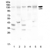 Western blot testing of rat 1) brain, 2) liver and mouse 3) brain, 4) spleen, 5) liver and 6) testis lysate with EPS15 antibody at 0.5ug/ml. Predicted molecular weight ~99 kDa, routinely observed at 120-150 kDa.