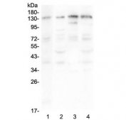 Western blot testing of human 1) A375, 2) HepG2, 3) Jurkat and 4) PANC-1 lysate with EPS15 antibody at 0.5ug/ml. Predicted molecular weight ~99 kDa, routinely observed at 120-150 kDa.