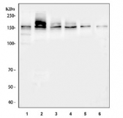 Western blot testing of 1) human Jurkat, 2) human K562, 3) human U-2 OS, 4) human U-251, 5) rat brain and 6) mouse brain tissue lysate with Periaxin antibody at 0.5ug/ml. Predicted molecular weight ~155 kDa.