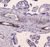 IHC testing of FFPE human placental tissue with MYLK antibody at 1ug/ml. Required HIER: steam section in pH6 citrate buffer for 20 min and allow to cool prior to staining.