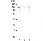 Western blot testing of 1) human SGC-7901, 2) rat spleen and 3) mouse spleen lysate with MYLK antibody at 0.5ug/ml. Predicted molecular weight: isoforms from 197-211 kDa and ~110 kDa, observed here at ~250 kDa.