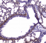 IHC testing of FFPE mouse lung tissue with MYLK antibody at 1ug/ml. Required HIER: steam section in pH6 citrate buffer for 20 min and allow to cool prior to staining.