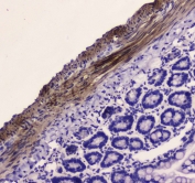 IHC testing of FFPE rat small intestine tissue with MYLK antibody at 1ug/ml. Required HIER: steam section in pH6 citrate buffer for 20 min and allow to cool prior to staining.