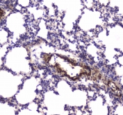 IHC testing of FFPE rat lung tissue with MYLK antibody at 1ug/ml. Required HIER: steam section in pH6 citrate buffer for 20 min and allow to cool prior to staining.