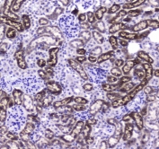 IHC testing of FFPE mouse kidney tissue with Carboxylesterase 1 antibody at 1ug/ml. Required HIER: steam section in pH6 citrate buffer for 20 min and allow to cool prior to staining.