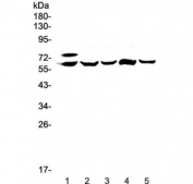 Western blot testing of 1) human HepG2, 2) rat liver, 3) rat lung, 4) mouse liver and 5) mouse lung lysate with Carboxylesterase 1 antibody at 0.5ug/ml. Predicted molecular weight ~63 kDa.
