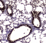 IHC testing of FFPE mouse lung tissue with Carboxylesterase 1 antibody at 1ug/ml. Required HIER: steam section in pH6 citrate buffer for 20 min and allow to cool prior to staining.