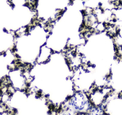 IHC testing of FFPE rat lung tissue with Carboxylesterase 1 antibody at 1ug/ml. Required HIER: steam section in pH6 citrate buffer for 20 min and allow to cool prior to staining.