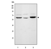 Western blot testing of 1) human ThP-1, 2) rat liver and 3) mouse HEPA1/6 cell lysate with Carboxylesterase 1 antibody at 0.5ug/ml. Predicted molecular weight ~63 kDa.