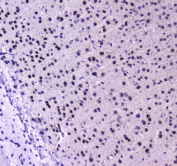 IHC testing of FFPE mouse brain tissue with RUNX1T1 antibody at 1ug/ml. Required HIER: steam section in pH6 citrate buffer for 20 min and allow to cool prior to staining.