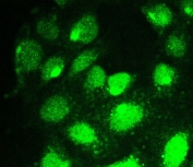 IF/ICC staining of FFPE human U-2 OS cells with RUNX1T1 antibody (green) at 2ug/ml. HIER: steam section in pH6 citrate buffer for 20 min.