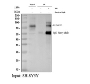 Immunoprecipitation of RUNX1T1 protein from 500ug of human SH-SY5Y whole cell lysate with 2ug of RUNX1T1 antibody.