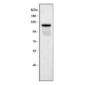 Western blot testing of mouse lung tissue lysate with VE Cadherin antibody at 0.5ug/ml. Expected molecular weight: 90~140 kDa depending on glycosylation level.