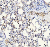 IHC staining of FFPE rat lung tissue with VE Cadherin antibody. HIER: boil tissue sections in pH8 EDTA for 20 min and allow to cool before testing.