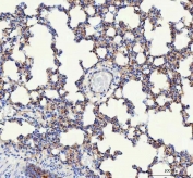 IHC staining of FFPE mouse lung tissue with VE Cadherin antibody. HIER: boil tissue sections in pH8 EDTA for 20 min and allow to cool before testing.
