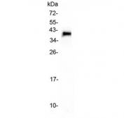 Western blot testing of recombinant human protein (1ng/lane) with TACI antibody at 0.5ug/ml. Predicted molecular weight ~32 kDa (full length, unmodified), observed here at ~40 kDa (AA 1-165 + purification tag).