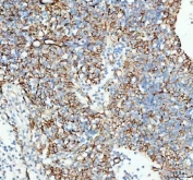 IHC staining of FFPE human spleen tissue with TACI antibody. HIER: boil tissue sections in pH8 EDTA for 20 min and allow to cool before testing.