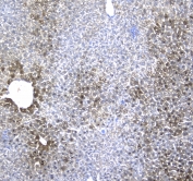 IHC testing of FFPE mouse liver tissue with IRF7 antibody at 1ug/ml. Required HIER: steam section in pH6 citrate buffer for 20 min and allow to cool prior to staining.
