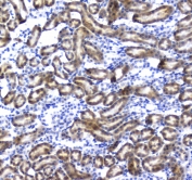 IHC testing of FFPE rat kidney tissue with IRF7 antibody at 1ug/ml. Required HIER: steam section in pH6 citrate buffer for 20 min and allow to cool prior to staining.