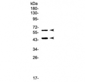 Western blot testing of human Raji cell lysate with TIM-3 antibody at 0.5ug/ml. Expected molecular weight: 33-70 kDa depending on glycosylation level.