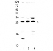 Western blot testing of 1) human SGC-7901, 2) rat testis and 3) mouse testis lysate with TPMT antibody at 0.5ug/ml. Predicted molecular weight ~28 kDa.