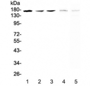 Western blot testing of 1) human A549, 2( (h) SK-OV-3, 3) (h) PANC-1, 4) rat brain and 5) mouse brain lysate with IRE1 antibody at 0.5ug/ml. Predicted molecular weight ~110 kDa, observed here at ~170 kDa.