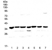 Western blot testing of rat 1) pancreas, 2) small intestine, 3) kidney and mouse 4) brain, 5) pancreas, 6) kidney and 7) testis lysate with uPA Receptor antibody at 0.5ug/ml. Predicted molecular weight ~37 kDa.