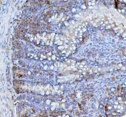 IHC staining of FFPE rat intestine tissue with BCMA antibody. HIER: boil tissue sections in pH8 EDTA for 20 min and allow to cool before testing.
