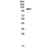 Western blot testing of human HeLa cell lysate with BCMA antibody at 0.5ug/ml. Expected molecular weight: 96-110 kDa.