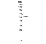 Western blot testing of human A375 cell lysate with TRIM5 antibody at 0.5ug/ml. Predicted molecular weight ~56 kDa.