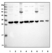 Western blot testing of human 1) MCF-7, 2) HeLa, 3) COLO-320, 4) HepG2, 5) PANC-1, 6) A375, 7) Jurkat and 8) placenta lysate with VAPB antibody at 0.5ug/ml. Predicted molecular weight ~27 kDa.