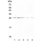 Western blot testing of 1) human PANC-1, 2) human SGC-7901, 3) human A549, 4) rat testis and 5) mouse testis lysate with VAPB antibody at 0.5ug/ml. Predicted molecular weight ~27 kDa.