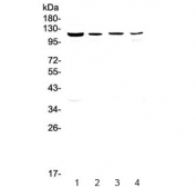 Western blot testing of rat 1) liver, 2) kidney, 3) brain and 4) heart lysate with RPGR antibody at 0.5ug/ml. Predicted molecular weight ~113 kDa.