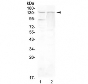 Western blot testing of rat 1) testis and 2) PC-12 lysate with RTEL1 antibody at 0.5ug/ml. Predicted molecular weight ~134 kDa.