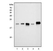 Western blot testing of human 1) HeLa, 2) MCF7, 3) HepG2, 4) 293T and 5) mouse testis lysate with RKIP antibody at 0.5ug/ml. Predicted molecular weight ~21 kDa.