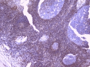 IHC testing of FFPE human tonsil with RKIP antibody at 1ug/ml. HIER: boil tissue sections in pH6, 10mM citrate buffer, for 10-20 min followed by cooling at RT for 20 min.