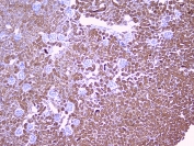 IHC testing of FFPE mouse kidney with RKIP antibody at 1ug/ml. HIER: boil tissue sections in pH6, 10mM citrate buffer, for 10-20 min followed by cooling at RT for 20 min.