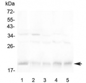 Western blot testing of 1) human Jurkat, 2) rat spleen, 3) rat thymus, 4) mouse spleen and 5) mouse thymus lysate with BAFF Receptor antibody at 0.5ug/ml. Predicted molecular weight ~19 kDa