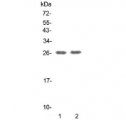 Western blot testing of human placenta lysate with E2F2 antibody at 0.5ug/ml. Predicted molecular weight: 47-52 kDa, observed here at ~70 kDa.