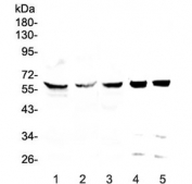 Western blot testing of human 1) HeLa, 2) HepG2, 3) MDA-MB-231, 4) rat testis and 5) mouse testis lysate with TCP1 eta antibody at 0.5ug/ml. Predicted molecular weight: ~59 kDa.