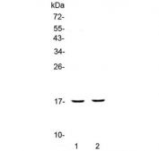 Western blot testing of different lots of human placenta lysate with PLAC9 antibody at 0.5ug/ml. Predicted molecular weight: ~10 kDa, observed here at ~17 kDa.