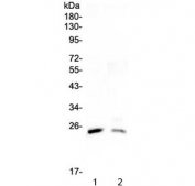 Western blot testing of 1) rat testis and 2) mouse testis lysate with StAR antibody at 0.5ug/ml. Expected molecular weight ~37 kDa (preprotein), ~30 kDa (mature form).