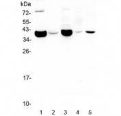 Western blot testing of 1) rat smooth muscle, 2) rat stomach, 3) mouse smooth muscle, 4) mouse stomach and 5) mouse RAW246.7 lysate with CD24 antibody at 0.5ug/ml. Expected molecular weight: 20-70 kDa depending on glycosylation level.