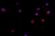 Immunofluorescent staining of FFPE human K562 cells with CD24 antibody (red) and DAPI nuclear stain (blue). HIER: steam section in pH6 citrate buffer for 20 min.