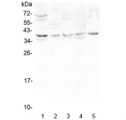 Western blot testing of human 1) HeLa, 2) placenta, 3) K562, 4) A549 and 5) Jurkat lysate with CD24 antibody at 0.5ug/ml. Expected molecular weight: 20-70 kDa depending on glycosylation level.