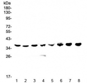Western blot testing of human 1) HeLa, 2) placenta, 3) MDA-MB-453, 4) SW620, 5) HepG2, 6) 22RV1, 7) A431 and 8) A375 lysate with HNRNPA2B1 antibody at 0.5ug/ml. Predicted molecular weight: ~36 kDa.