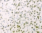 IHC staining of FFPE mouse brain with HNRNPA2B1 antibody. HIER: boil tissue sections in pH8 EDTA for 20 min and allow to cool before testing.